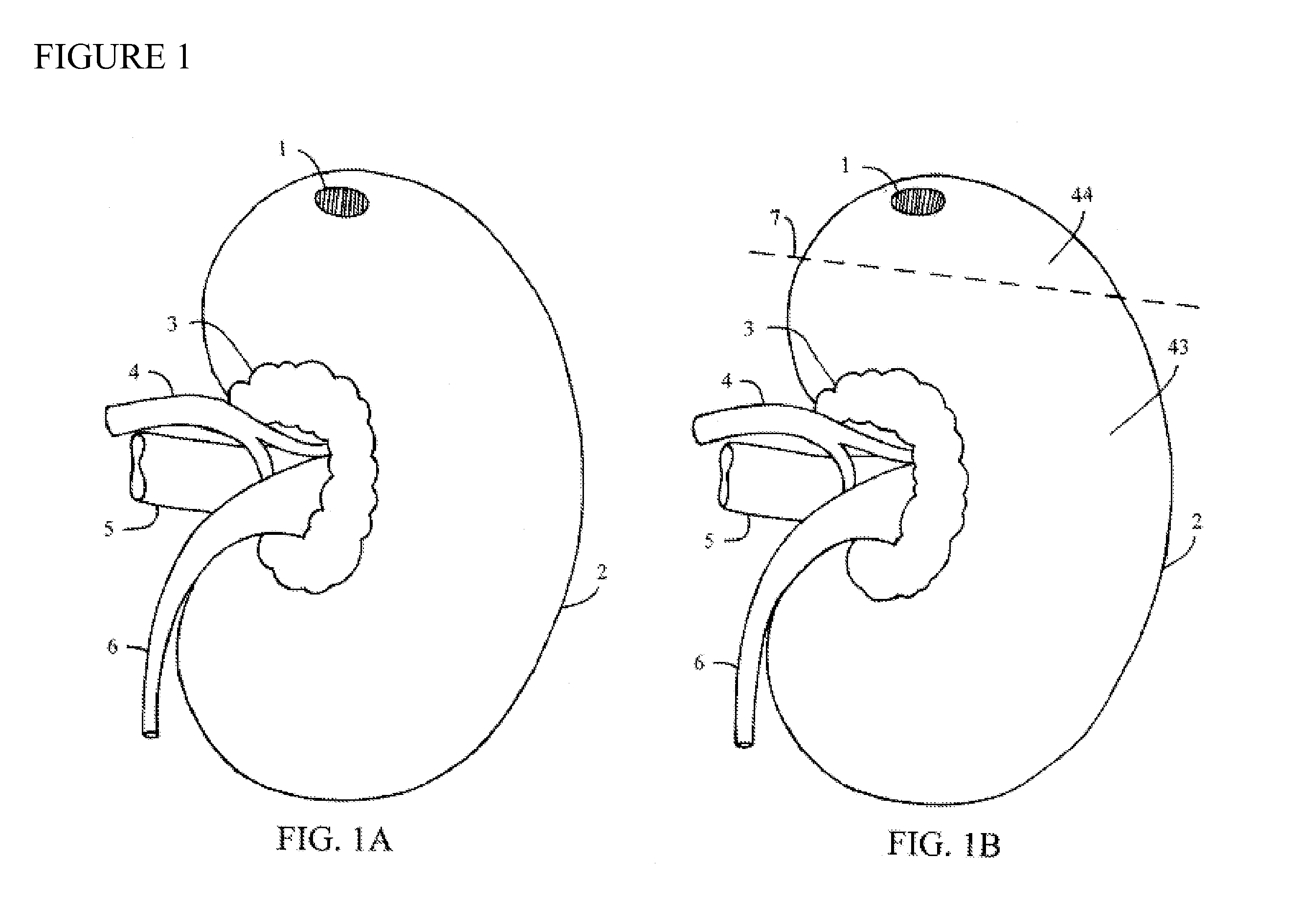 Apparatus for clamping an organ during surgery