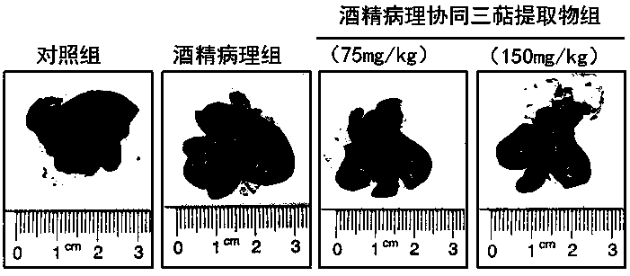 Rosa roxburghii triterpenoid extract and application thereof