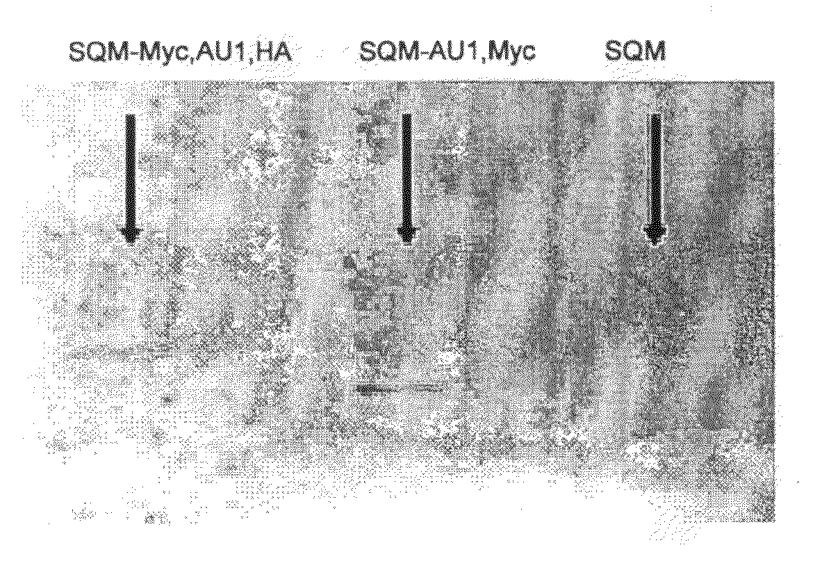 Modified stefin a scaffold proteins