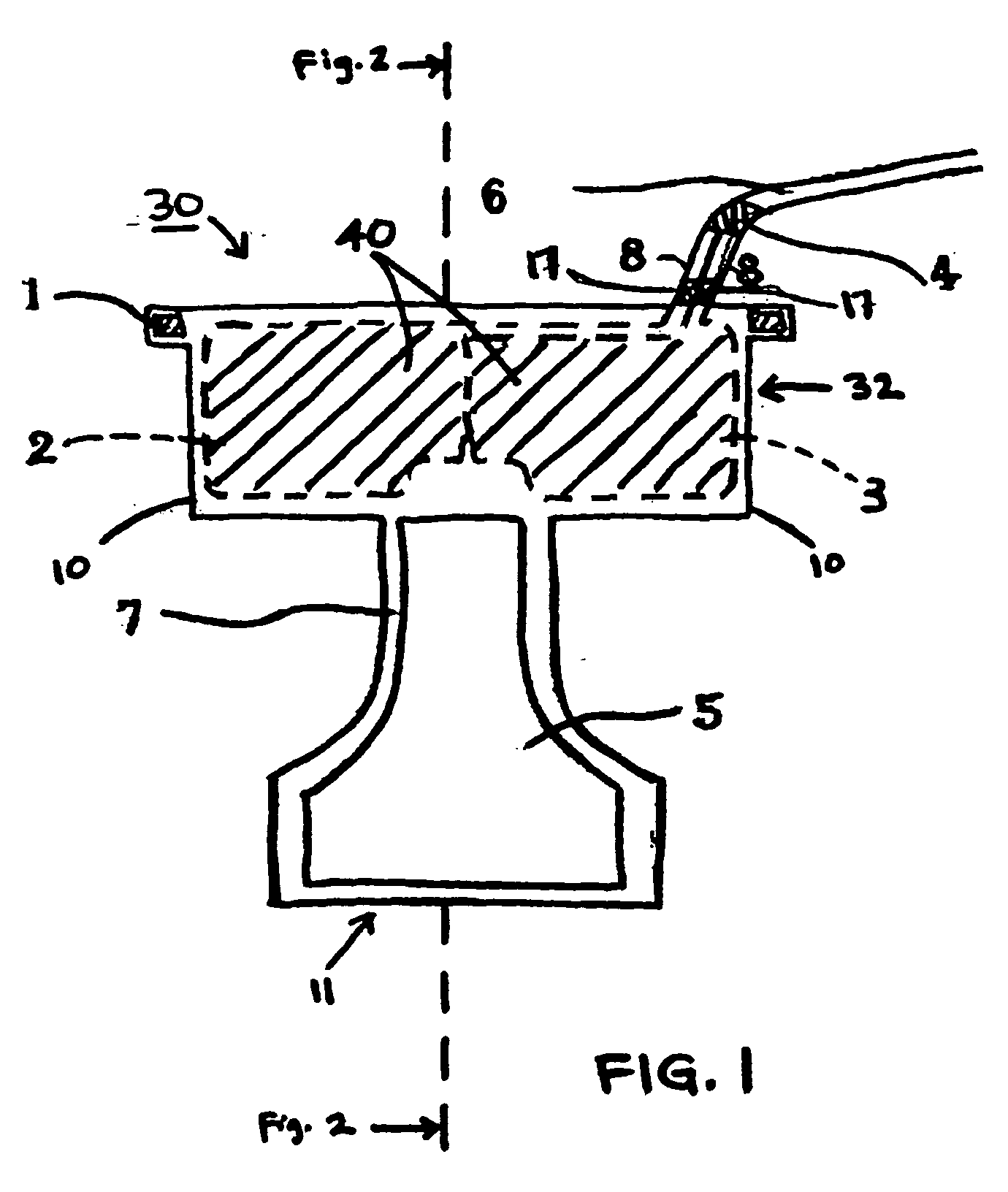 Apparatus for prevention and treatment of decubitus ulcers