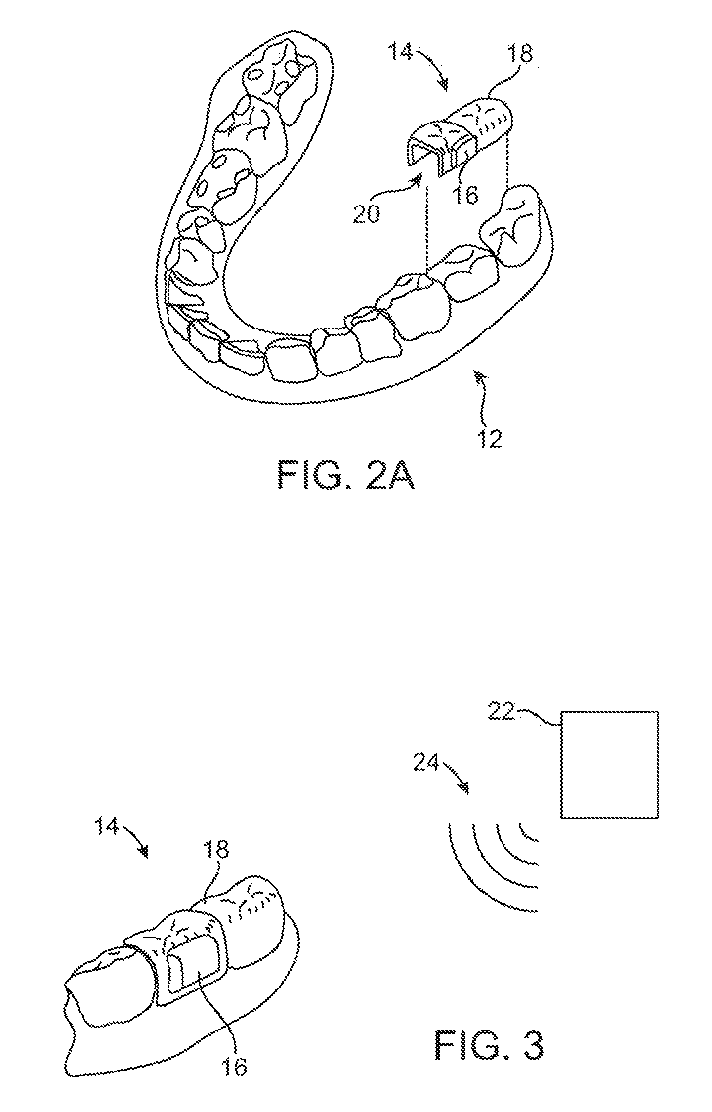 Methods and systems for tinnitus treatment