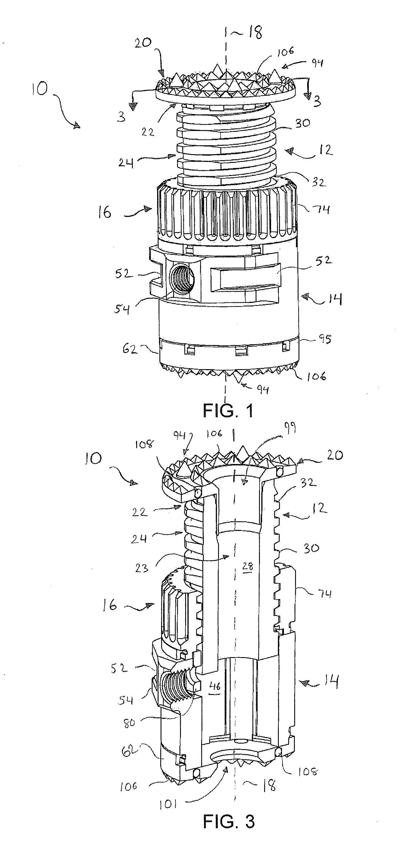 Expandable Vertebral Implant