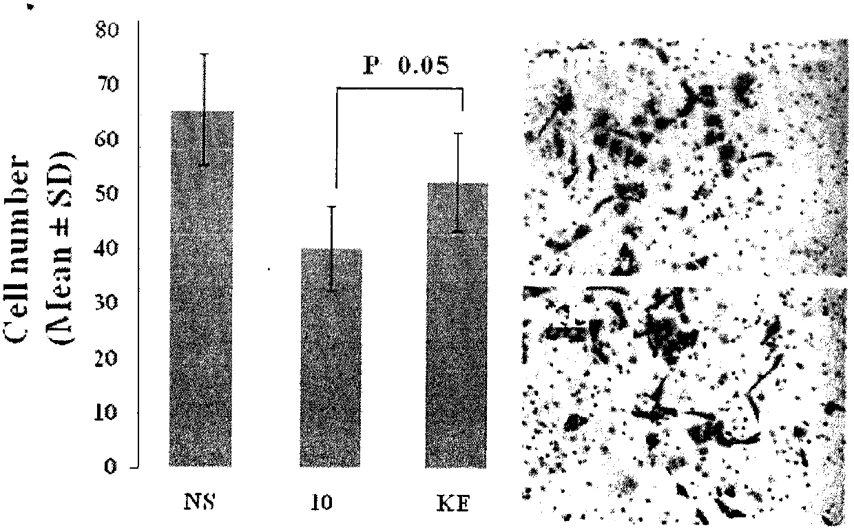 Lys-glu modified curcumin, its preparation, biological activity and application