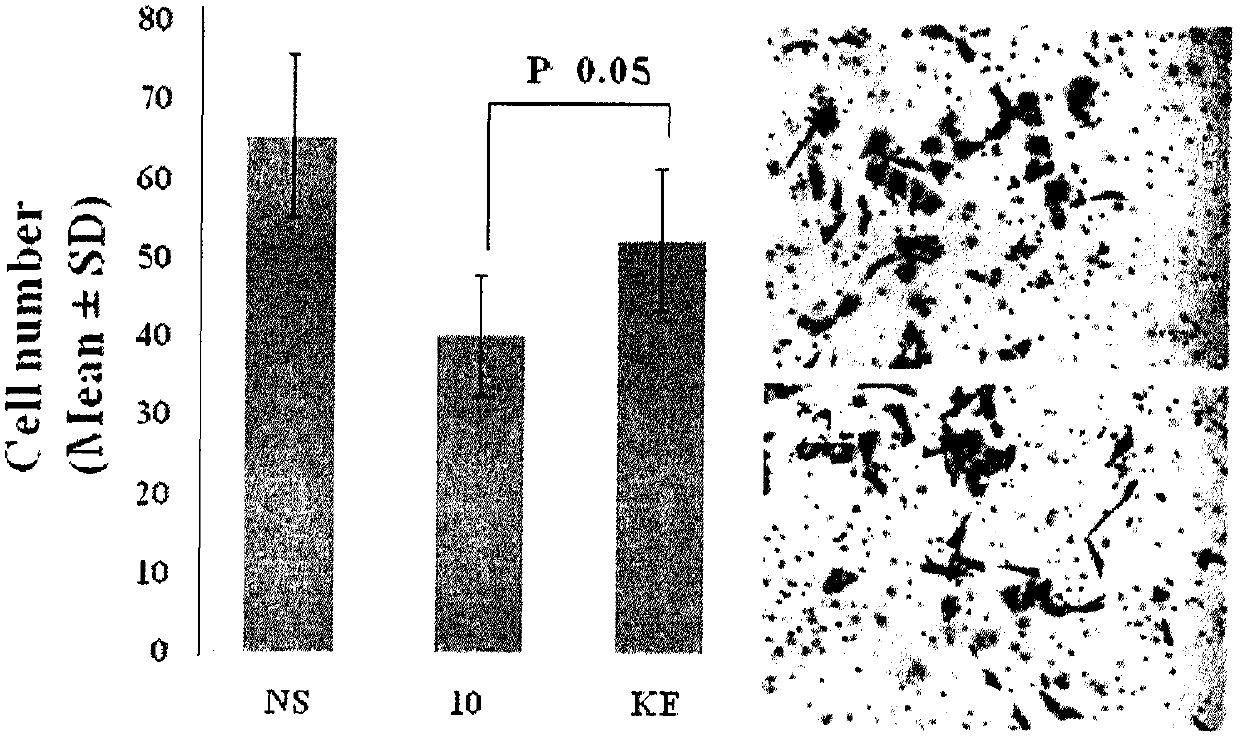 Lys-glu modified curcumin, its preparation, biological activity and application