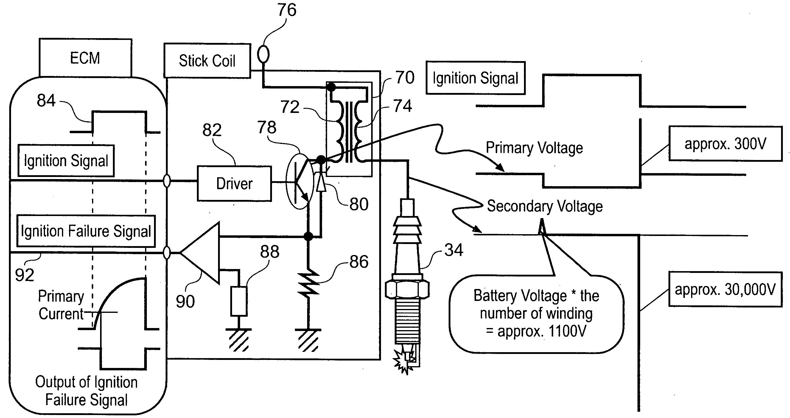 Electronic valve system