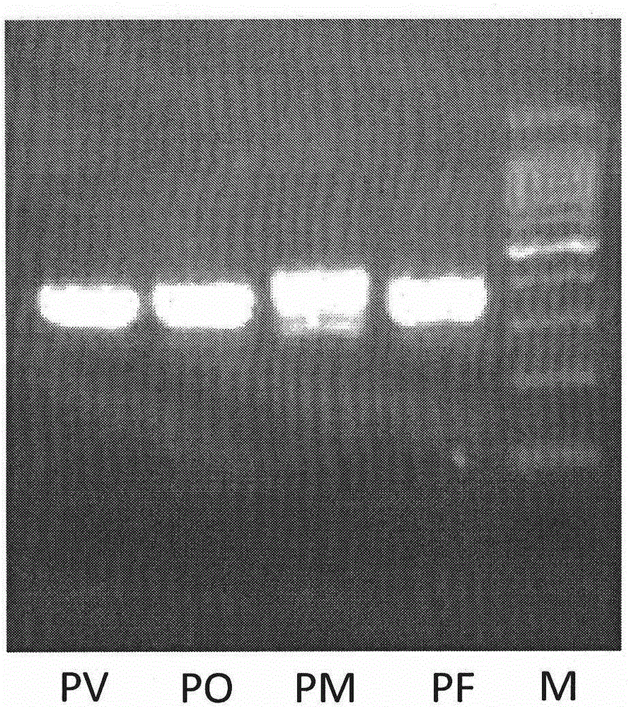 Probe for classificatory diagnosis of four plasmodia infecting human, kit and using method thereof