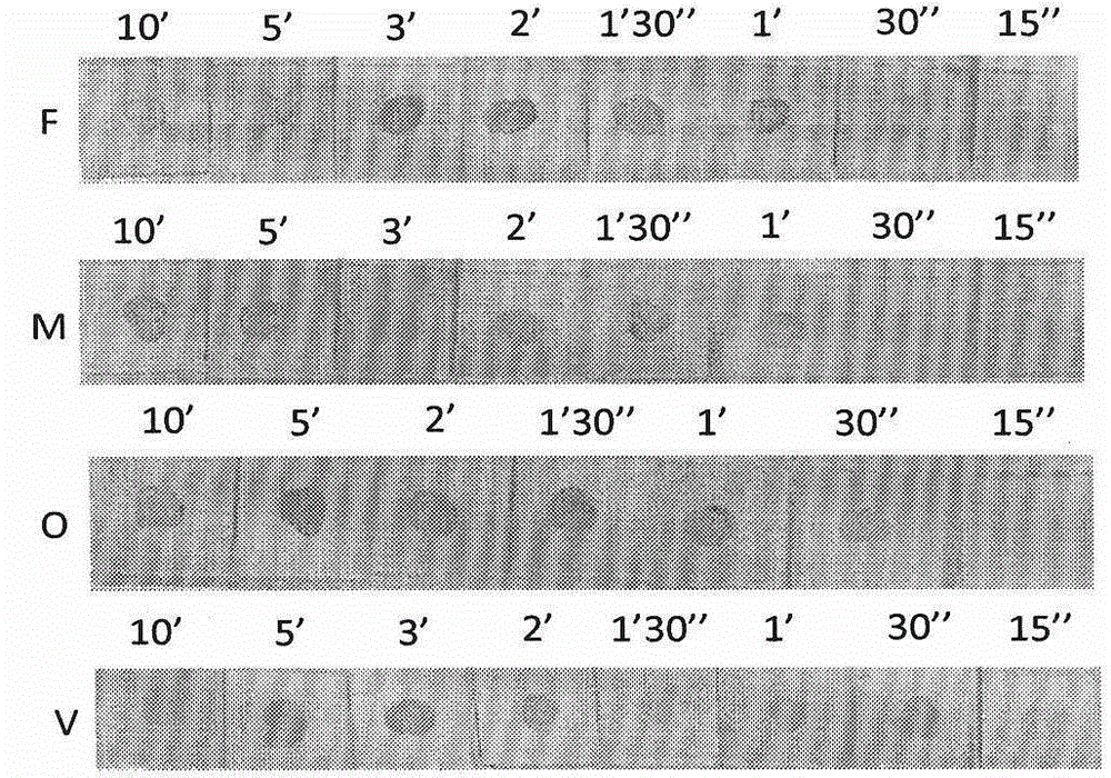 Probe for classificatory diagnosis of four plasmodia infecting human, kit and using method thereof