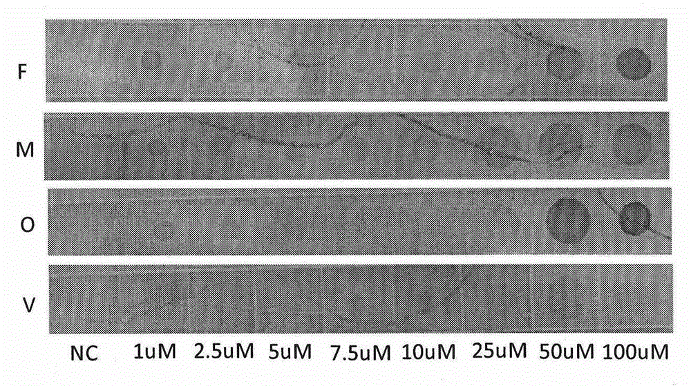 Probe for classificatory diagnosis of four plasmodia infecting human, kit and using method thereof