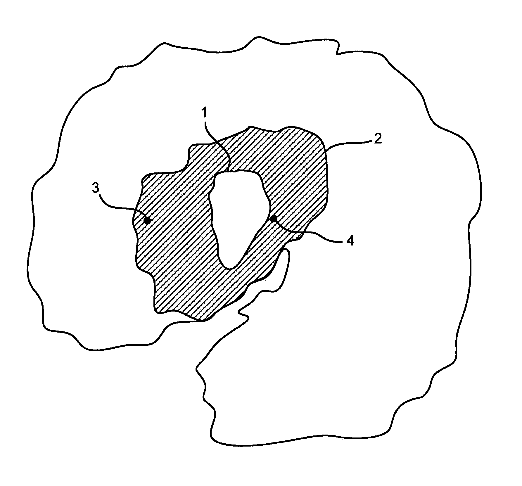 Magnetic resonance spatial risk map for tissue outcome prediction