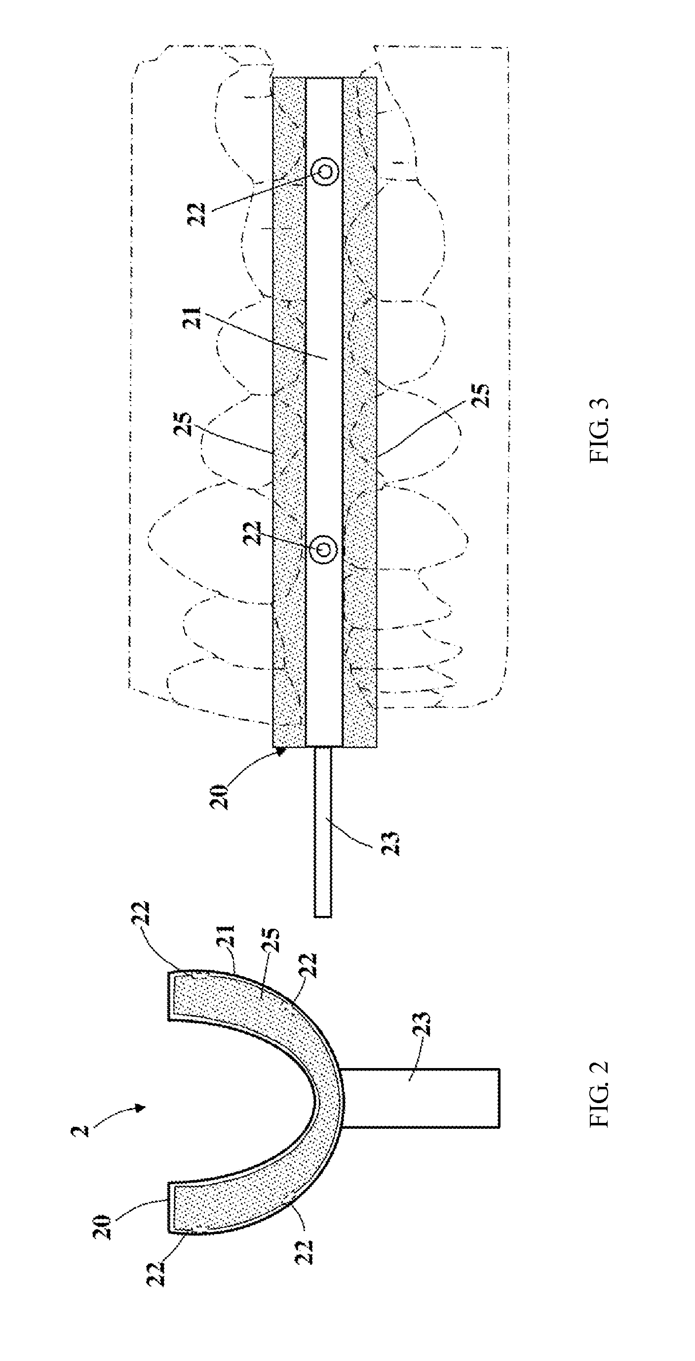 Automated orthodontic bracket positioning system and method