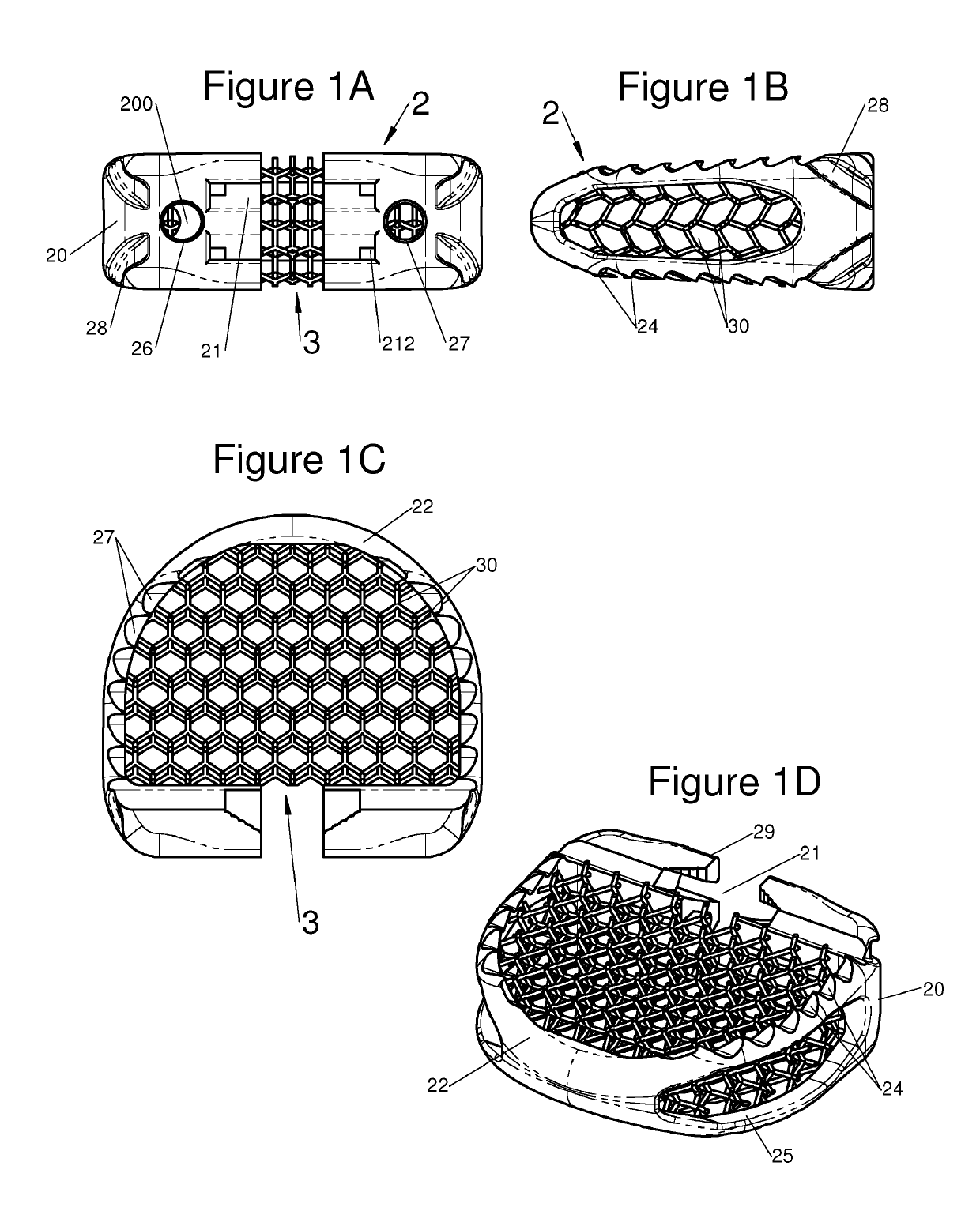 Vertebral system, implant and inserts for vertebral system