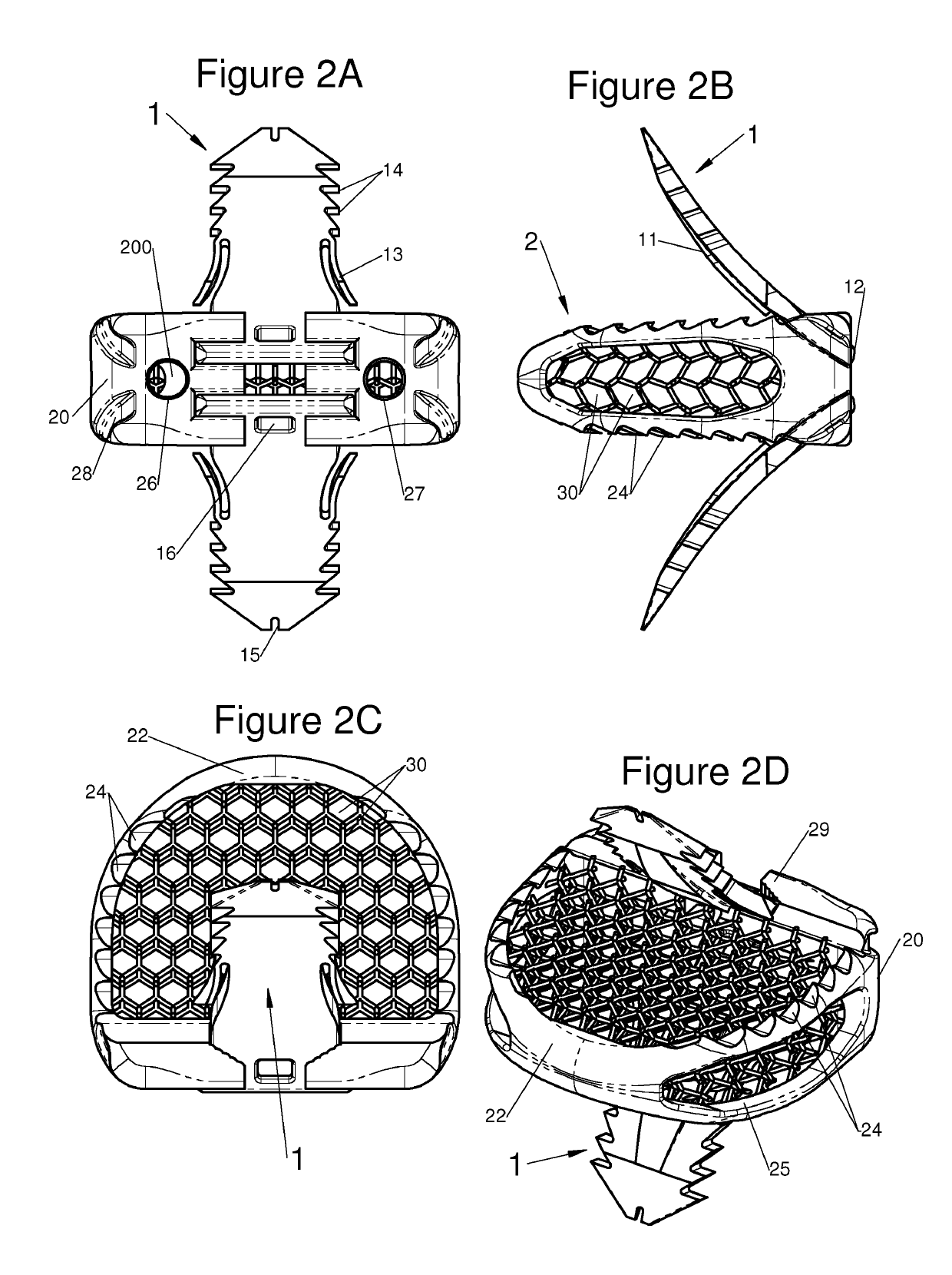 Vertebral system, implant and inserts for vertebral system