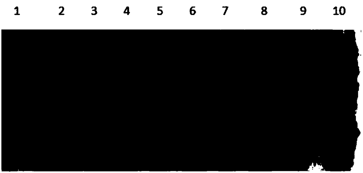 Recombinant soluble human-derived bone targeted interferon gamma-1b and preparation method thereof