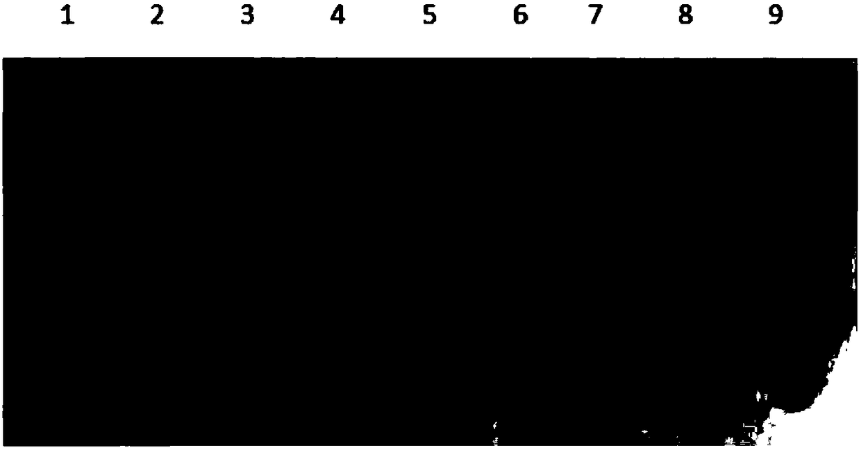 Recombinant soluble human-derived bone targeted interferon gamma-1b and preparation method thereof