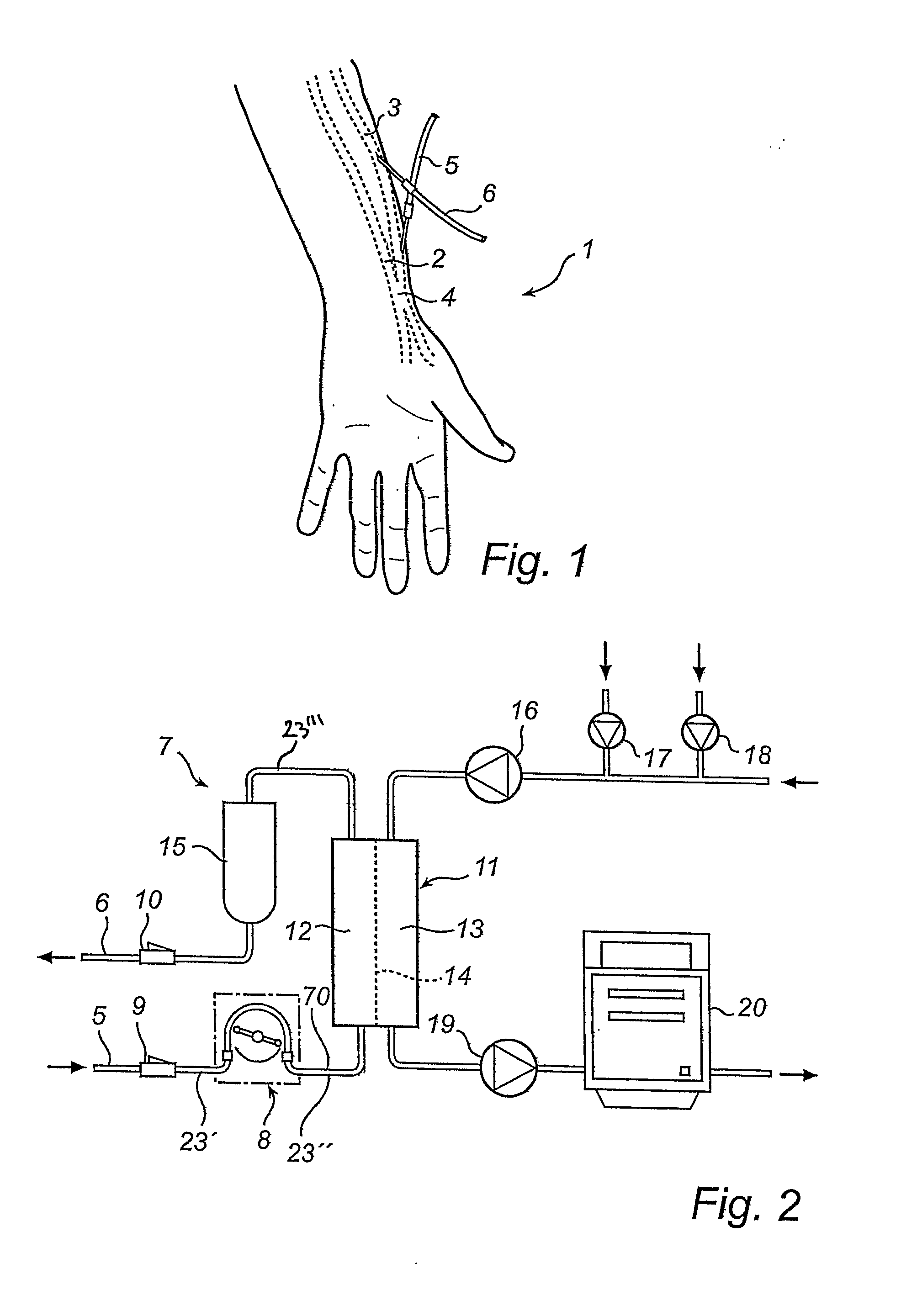 Pressure sensing