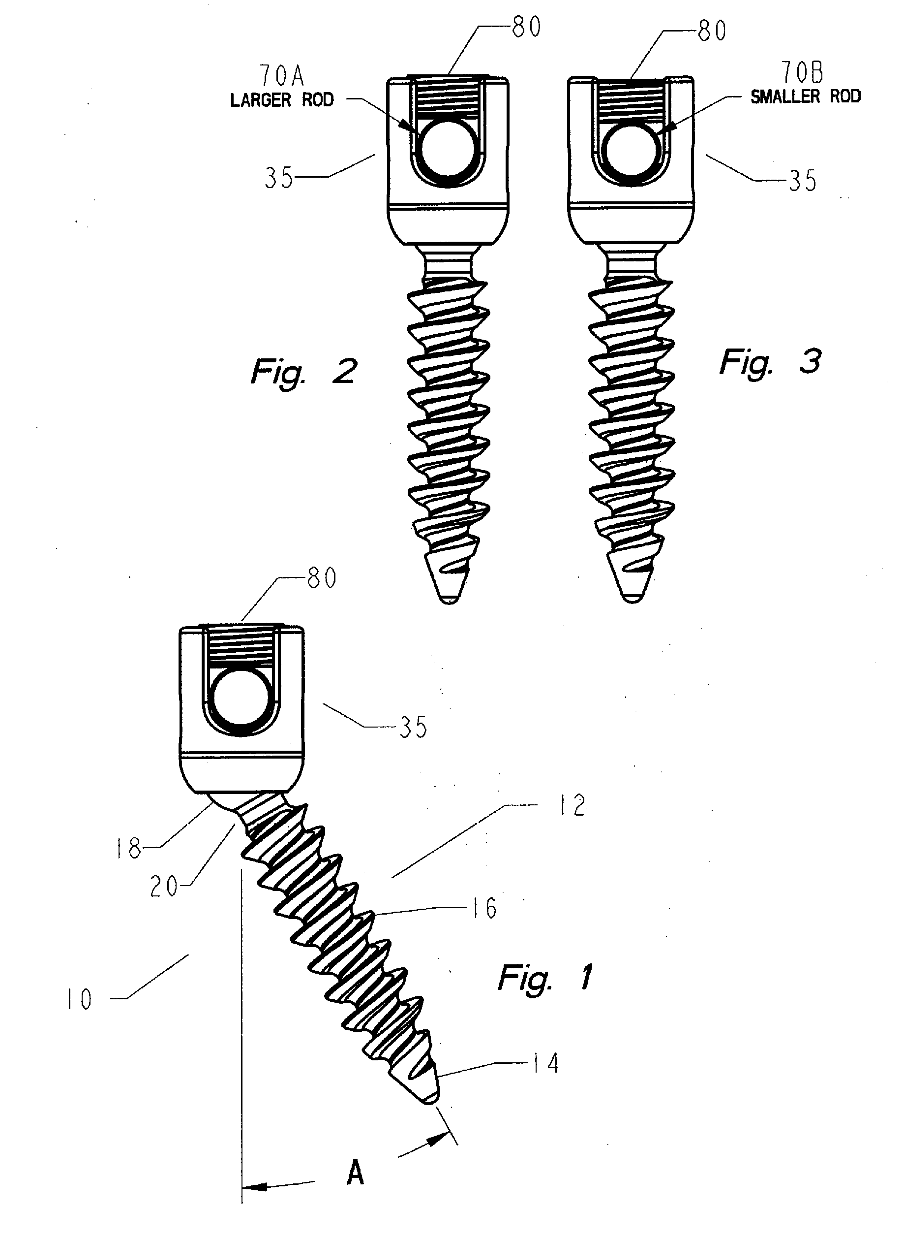 Thread-thru polyaxial pedicle screw system