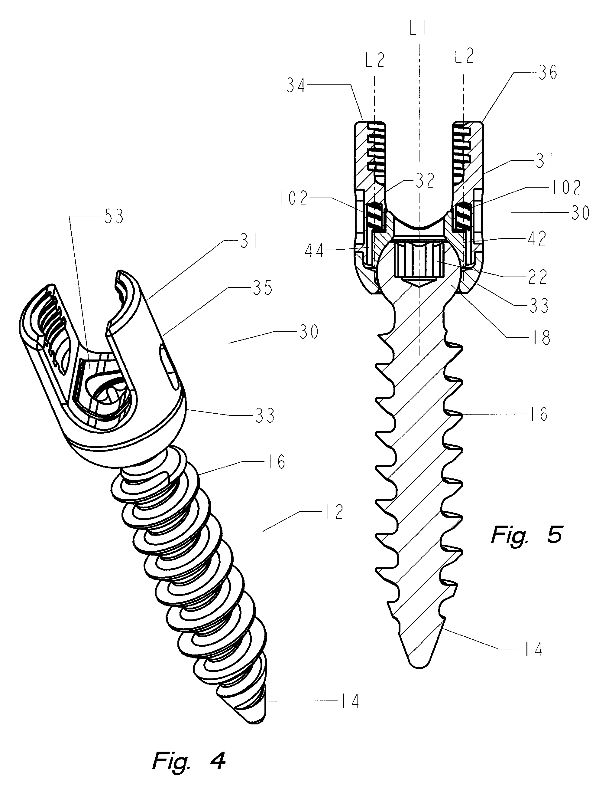 Thread-thru polyaxial pedicle screw system