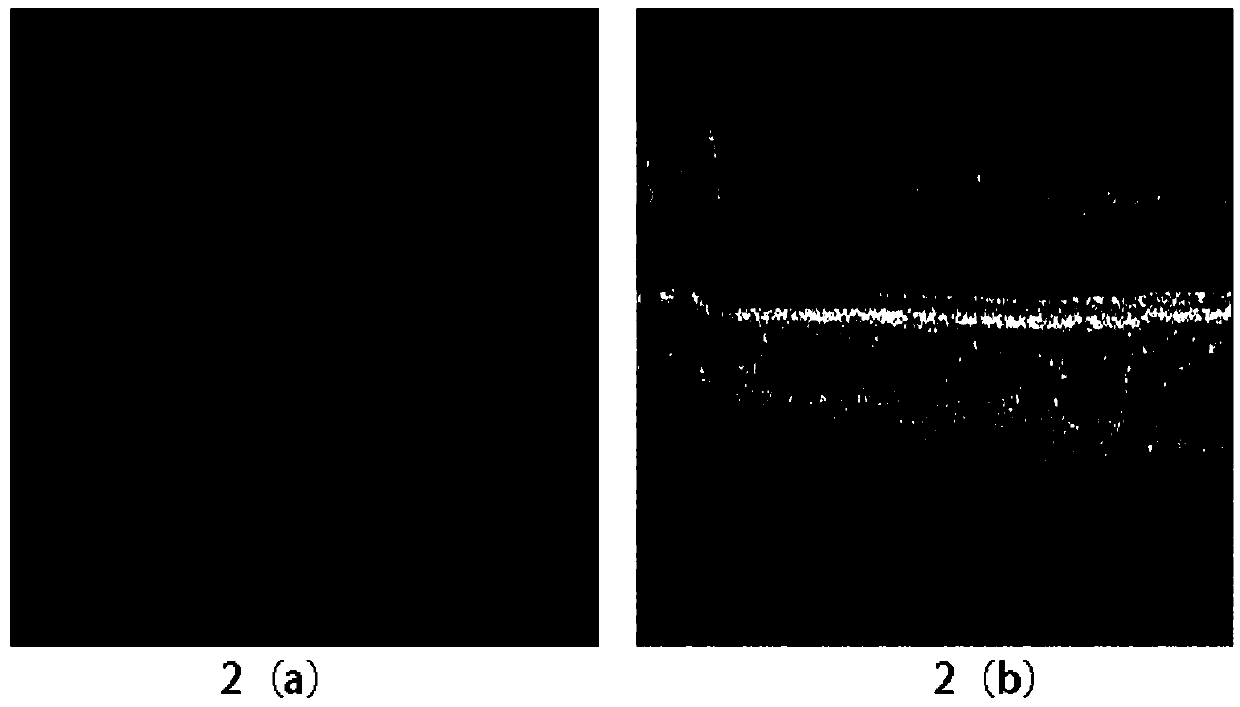 Choroidal angiography method and device based on optical coherence tomography imaging body scanning