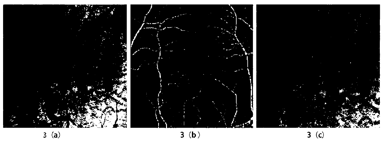 Choroidal angiography method and device based on optical coherence tomography imaging body scanning