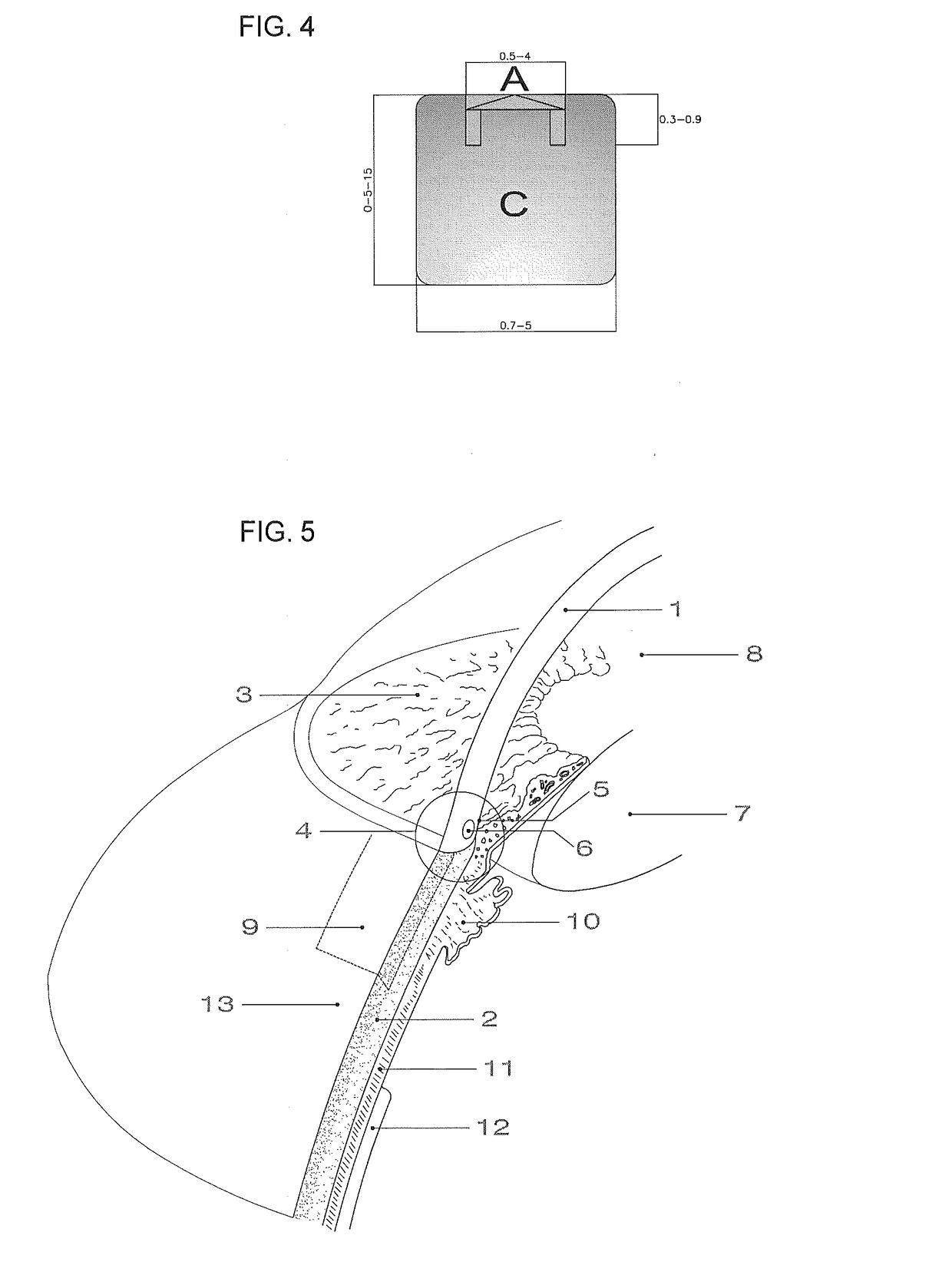 One piece flat device of for the drainage of aqueous humor from the eye