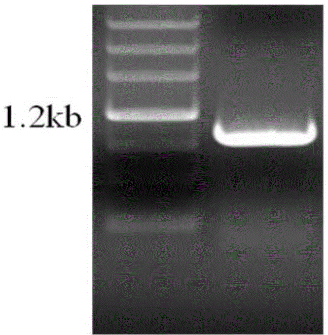 A kind of genetically engineered bacteria producing hyaluronic acid and its application