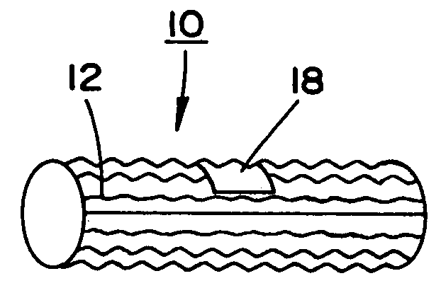 Stent and balloon system for bifurcated vessels and lesions