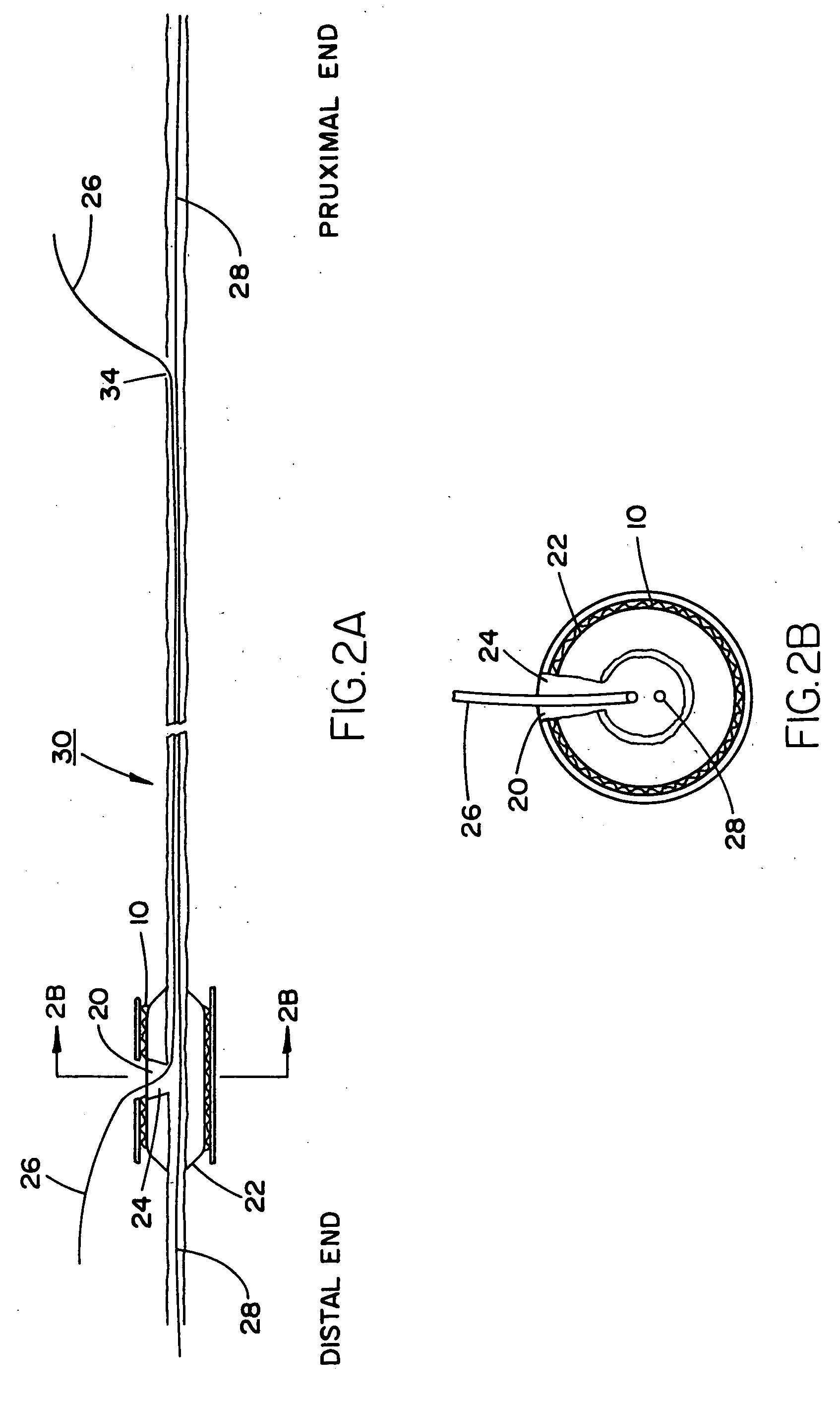 Stent and balloon system for bifurcated vessels and lesions