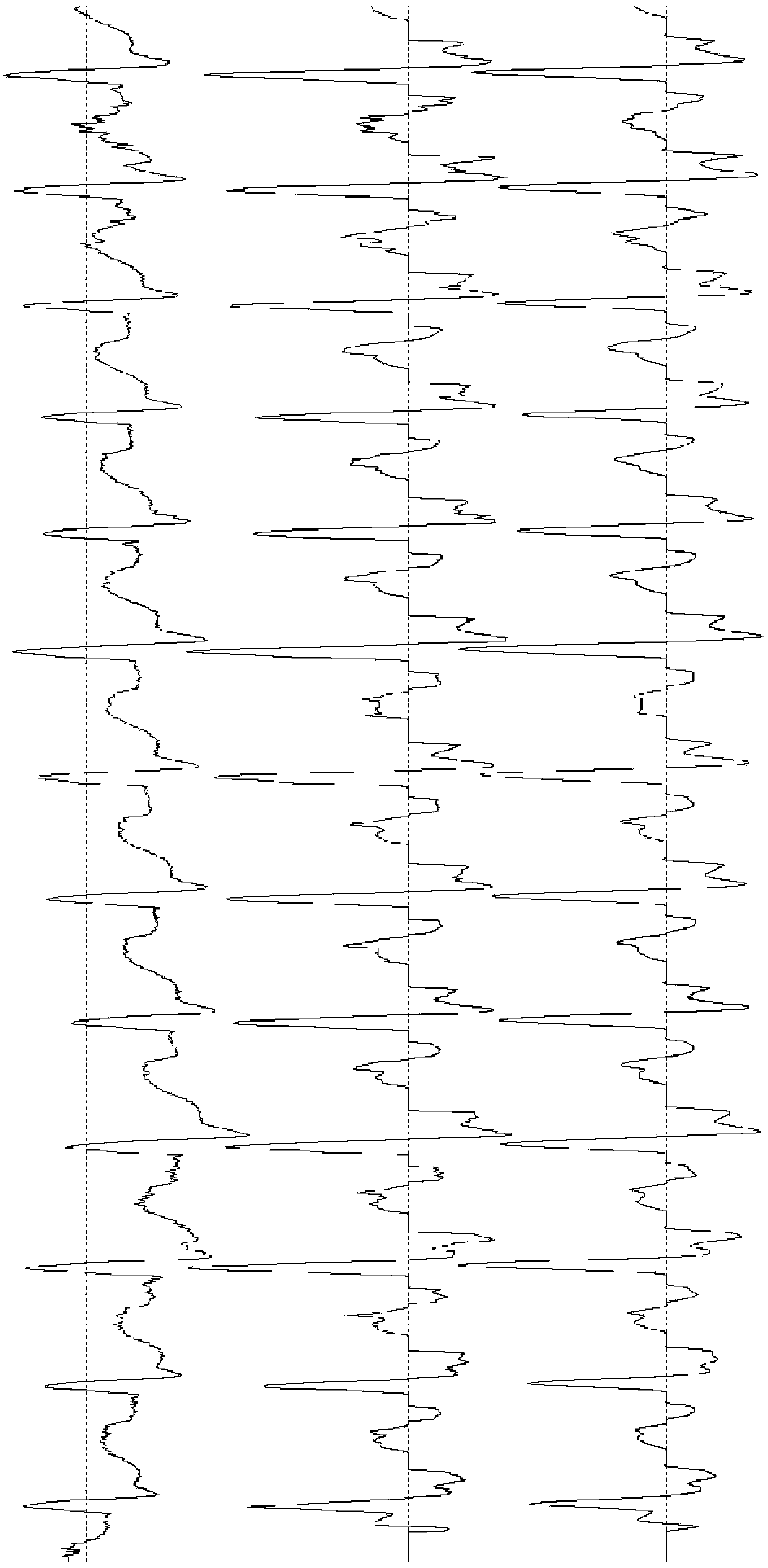 Electrocardiograph signal baseline filtering method