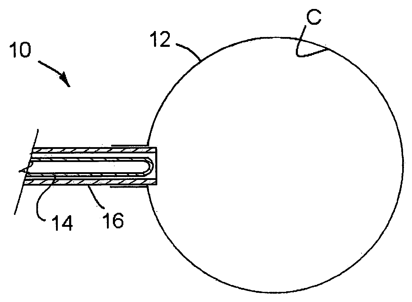 Brachytherapy Apparatus and Method Using Rotating Radiation Source