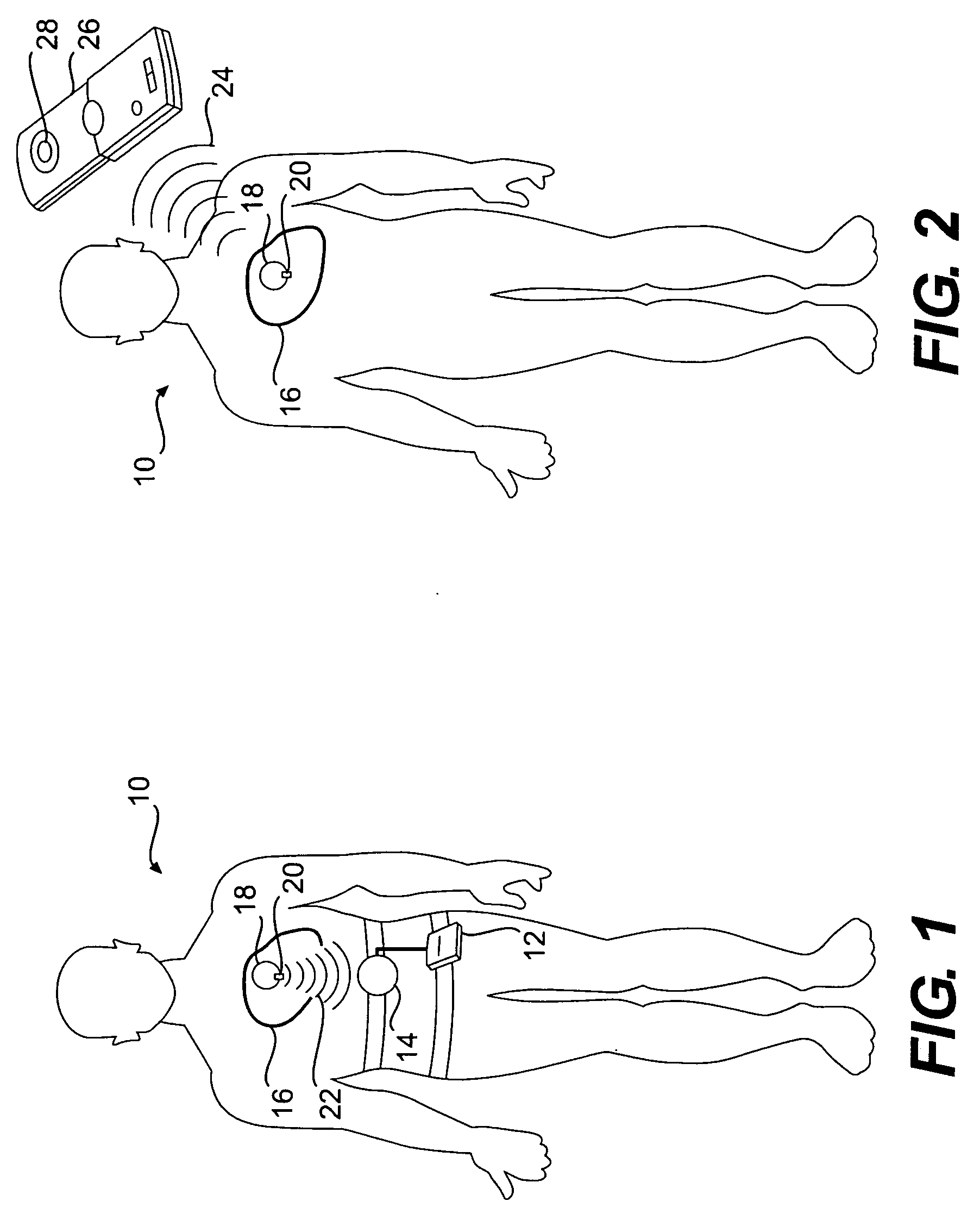 Implantable pressure monitor