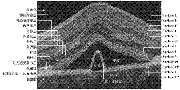 OCT (Optical Coherence Tomography) image segmentation method based on random forest and composite active curve