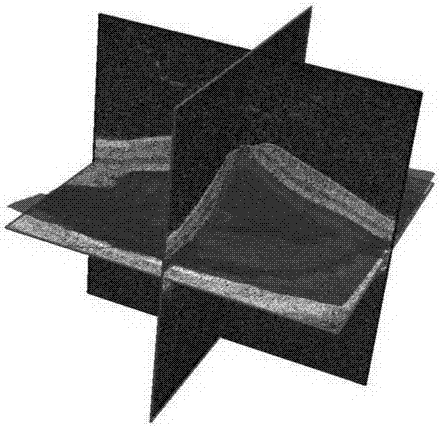 OCT (Optical Coherence Tomography) image segmentation method based on random forest and composite active curve