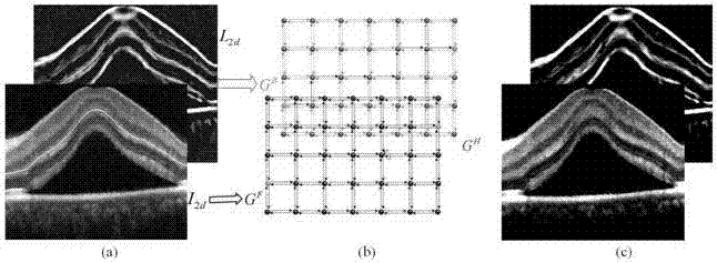 OCT (Optical Coherence Tomography) image segmentation method based on random forest and composite active curve