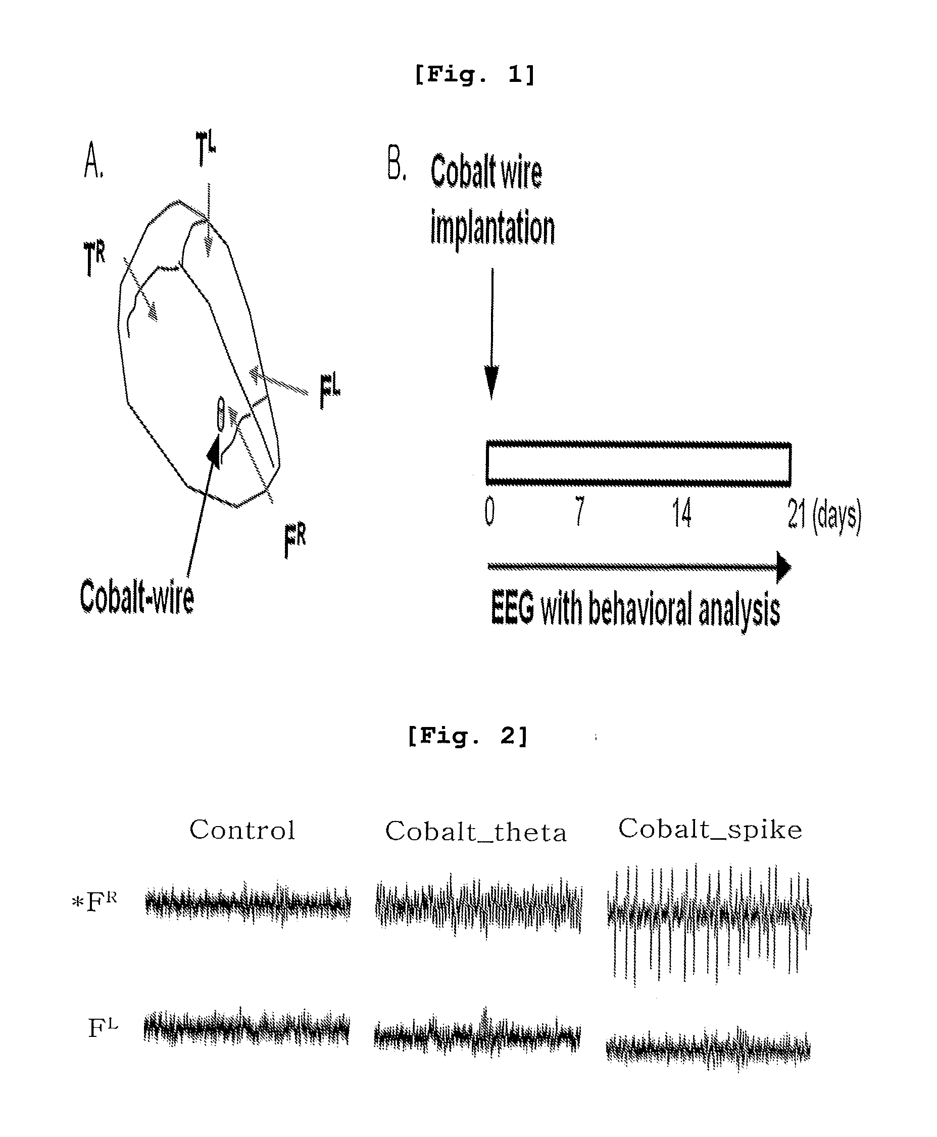 Model Mouse of Attention Deficit Hyperactivity Disorder, Method for Investigating Effects for Preventing and Alleviating Attention Disorder using the Model Mouse, and Method for Treating Attention Disorder by Suppressing T-Type Calcium Channel