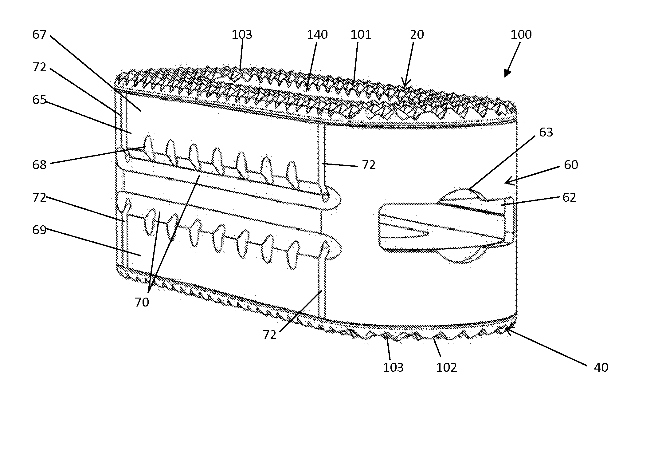 Expandable spinal implant