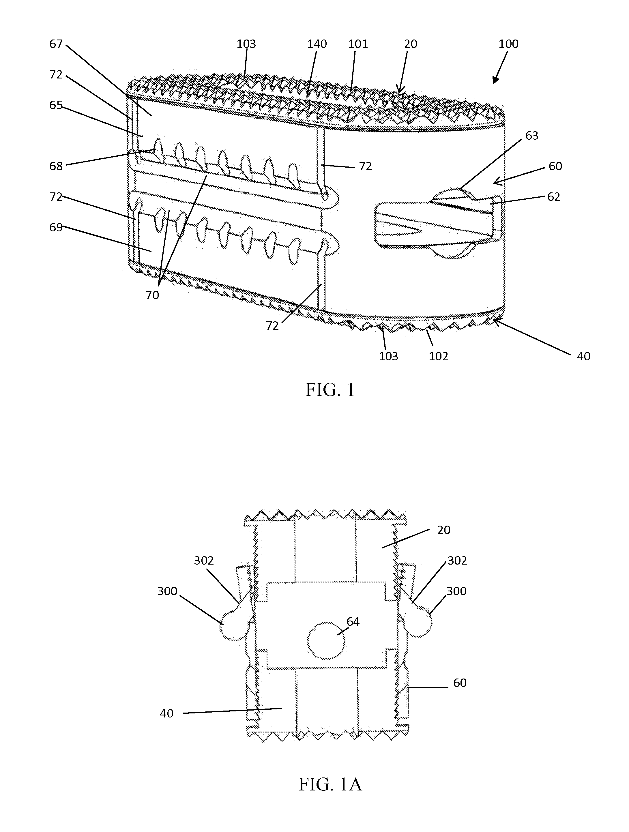 Expandable spinal implant