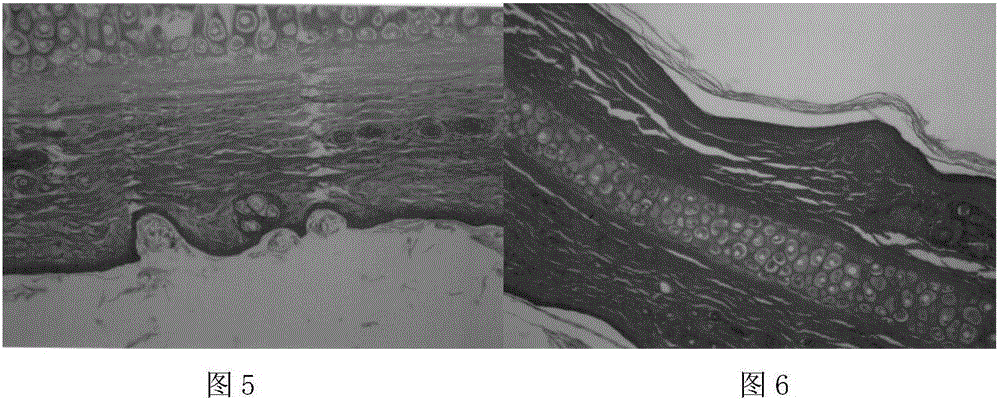 Externally-applied traditional Chinese medicine composition with effect on inhibiting acnes, phospholipid complex as well as preparation method and application thereof