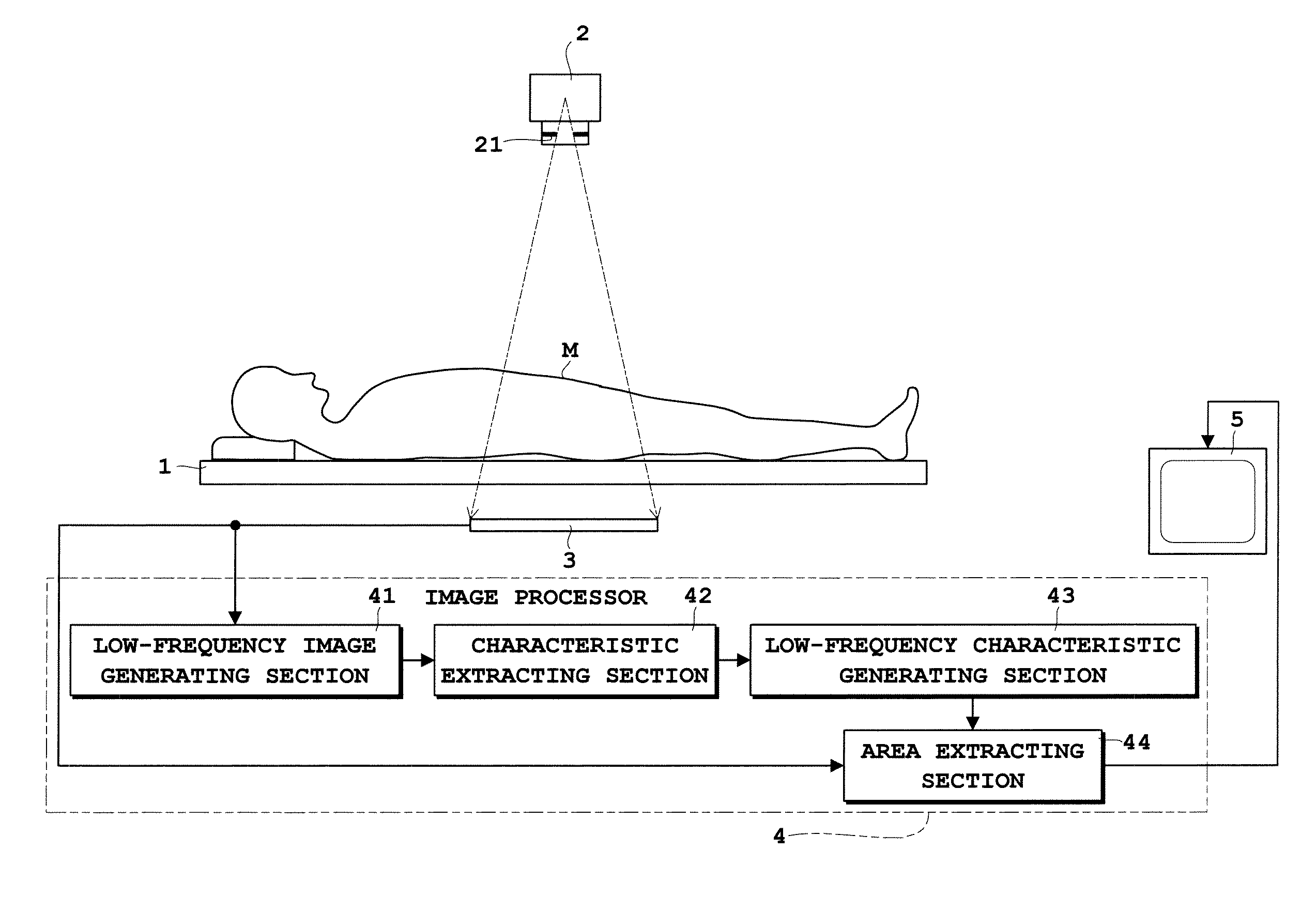 Radiographic image processing apparatus and radiographic image processing program