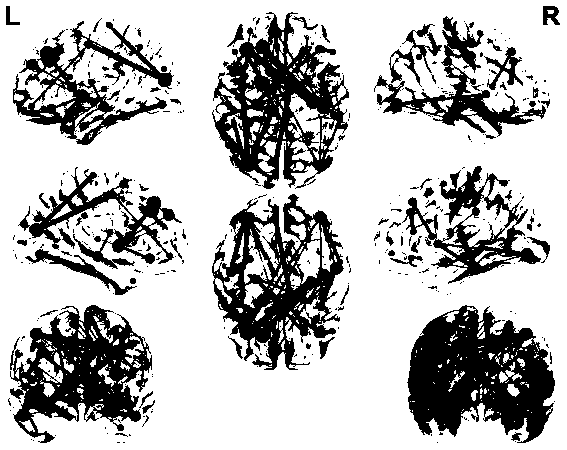 Graph-convolutional-neural-network-based auxiliary diagnosis method for Alzheimer's disease