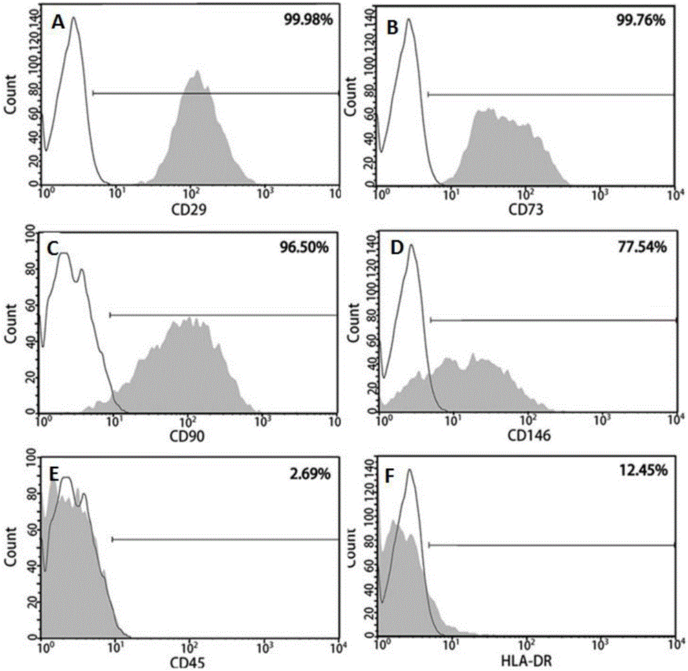 Application of urine stem cells in preparation of drug for improving glucose metabolism of mouse