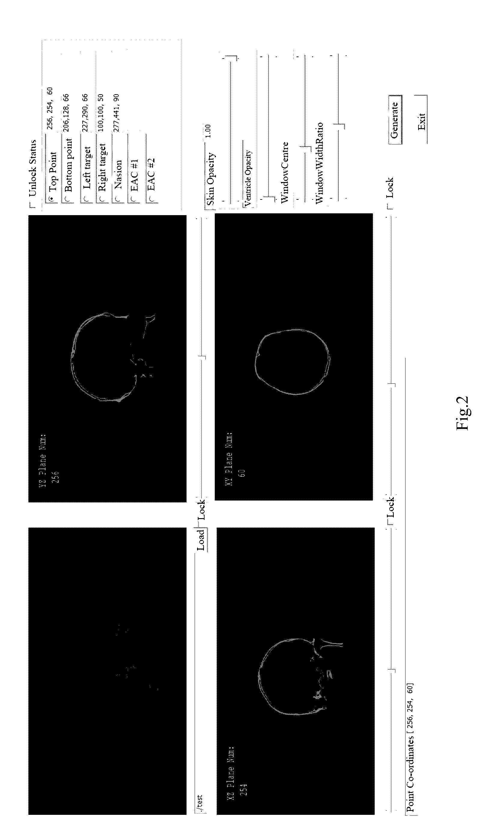 Method and apparatus for positioning navigation in a human body by means of augmented reality based upon a real-time feedback