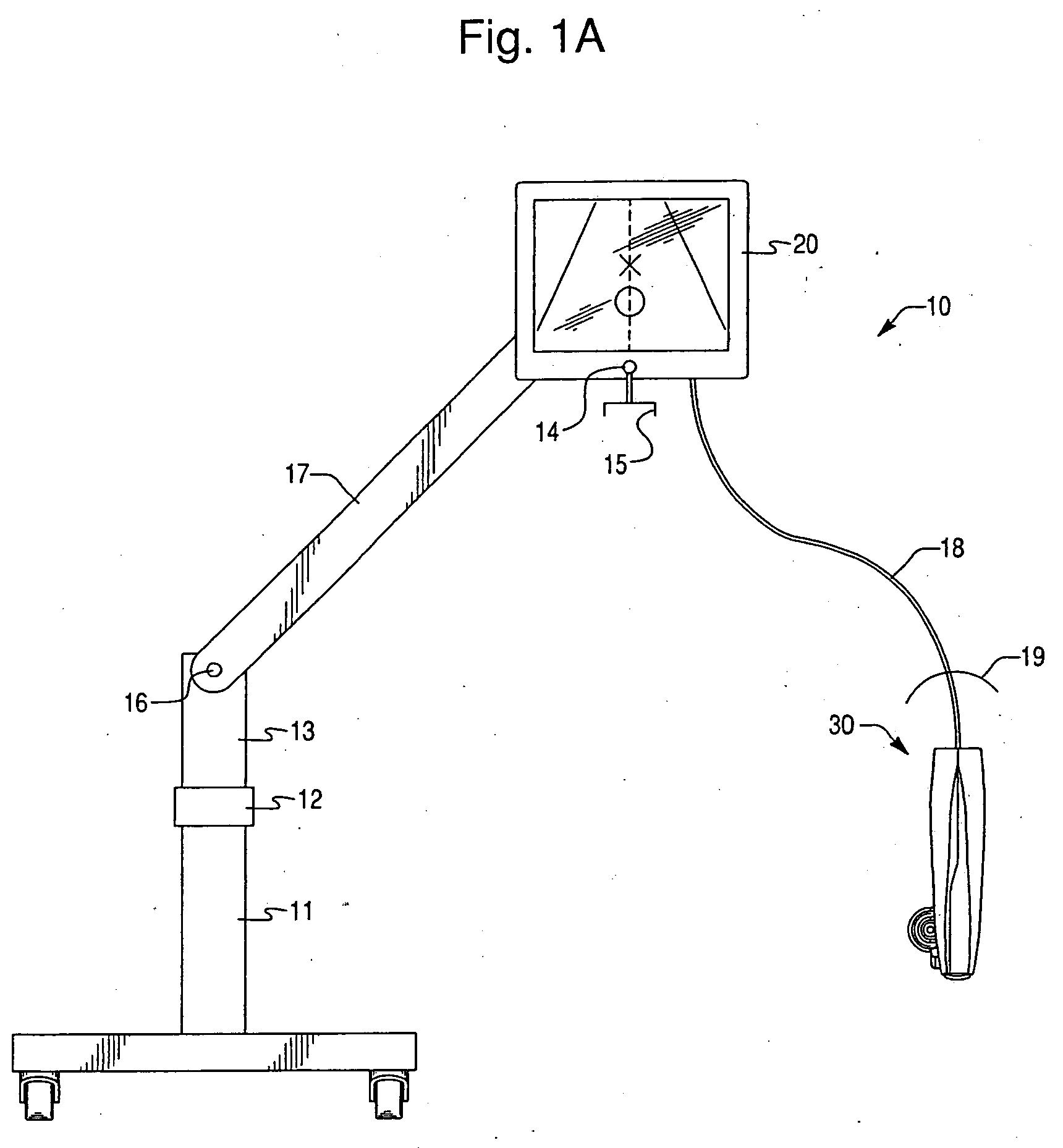 Ultrasound guidance system