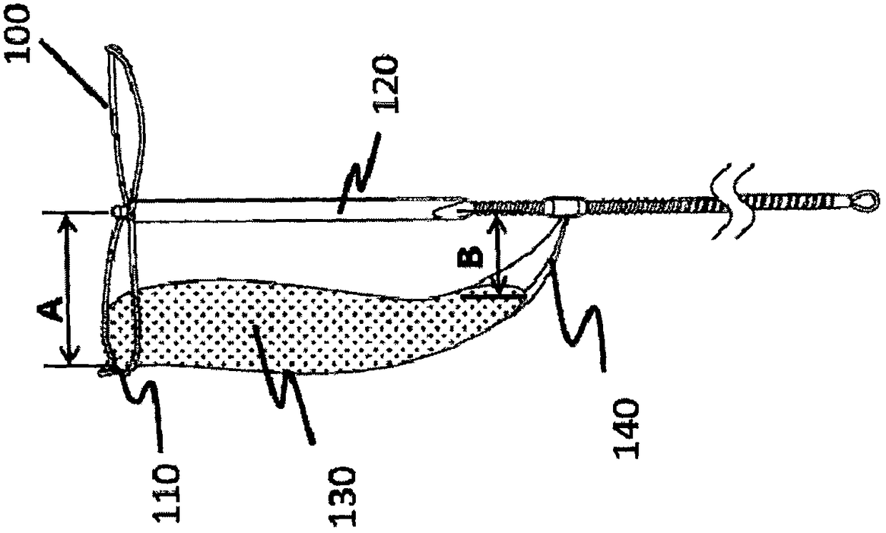 Implantation instrument for preventing regurgitation jet and delivery system therefor