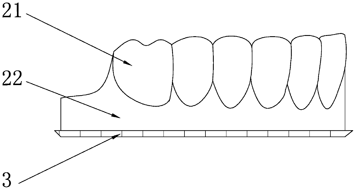 Method for obtaining invisaligner master mold through 3D printing and invisaligner master mold