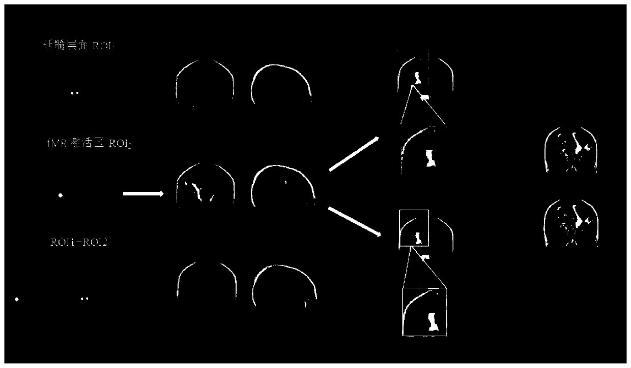 Corticospinal tract fiber tracing method based on FMRI and DTI fusion