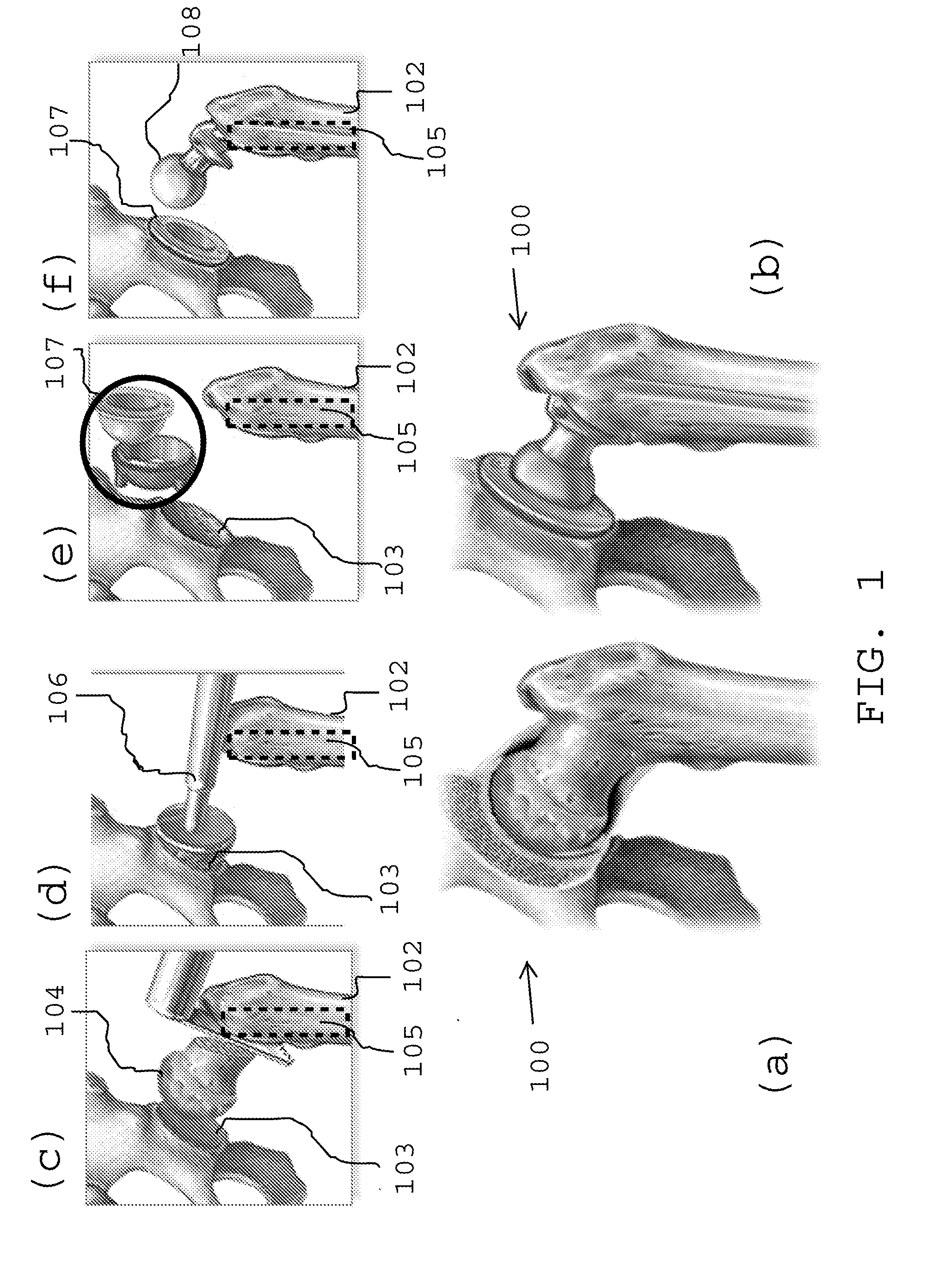 Posterior tissue retractor for use in hip replacement surgery