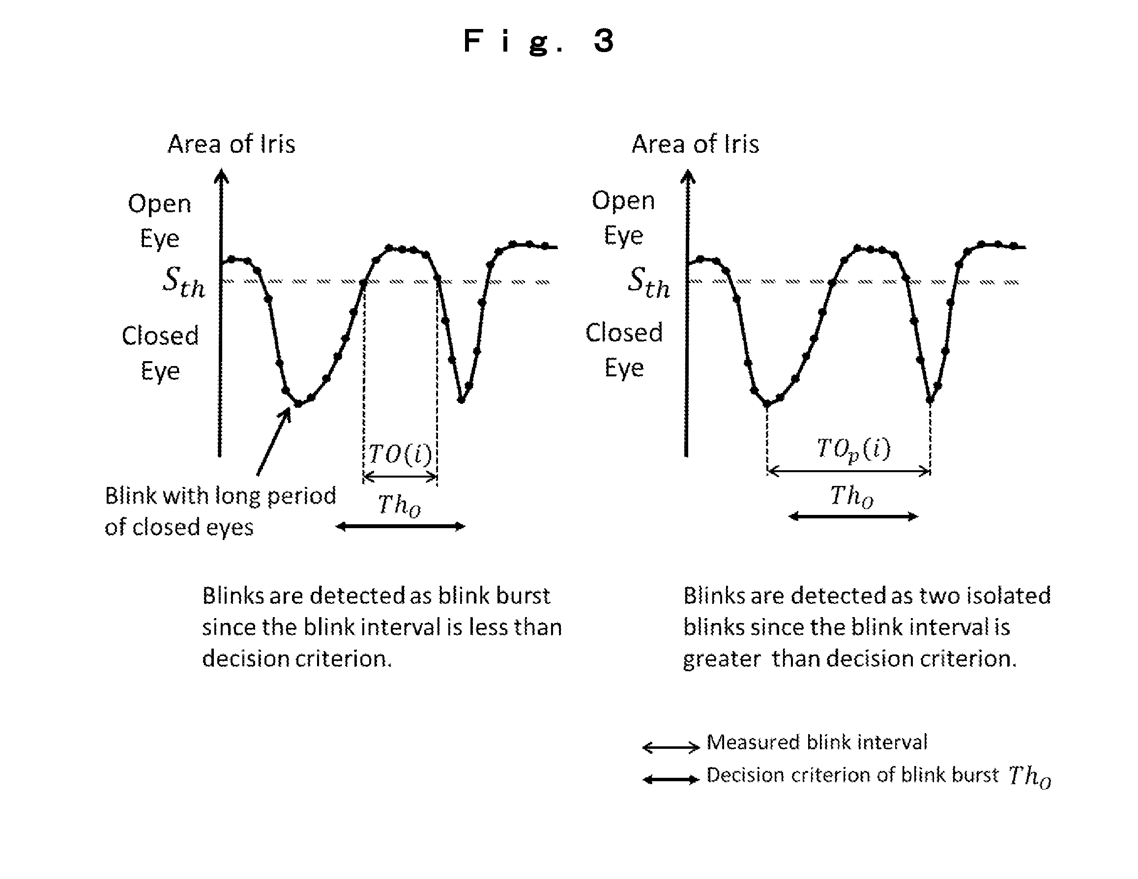 Doze detection method and apparatus thereof