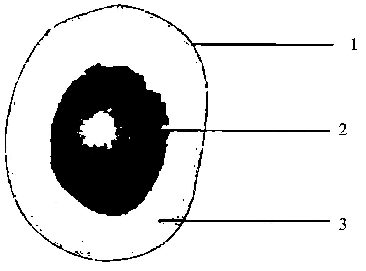 Urine-based early-stage bladder cancer examination method and system