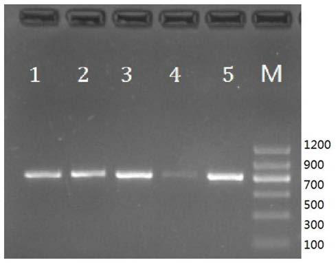 Lysis solution, extraction solution, lysis and extraction methods, kits and applications, PCR system