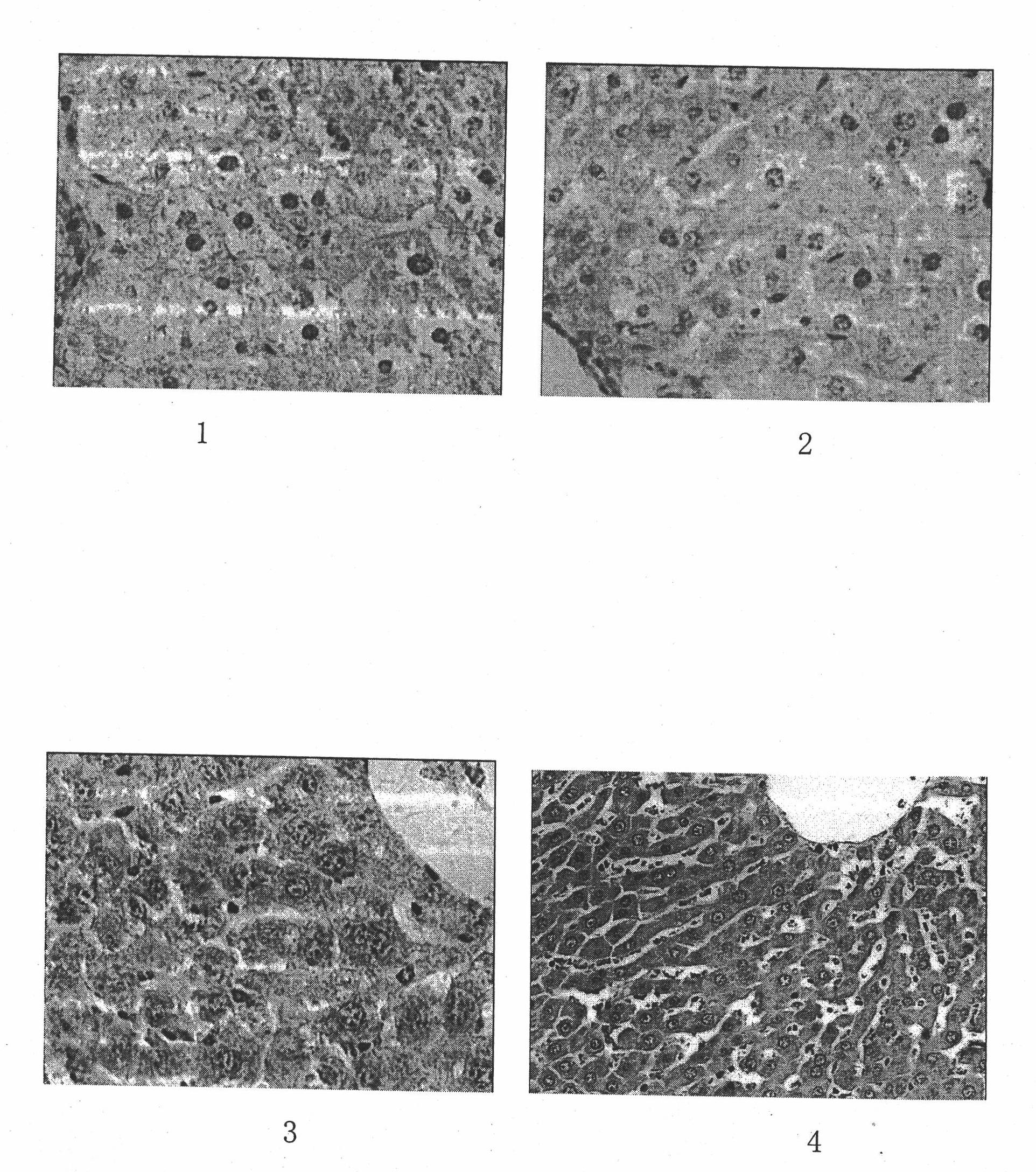 Jiantangcha (blood glucose benefiting tea) capsule for adjunctively reducing blood glucose and improving symptoms of diabetes and preparation method thereof